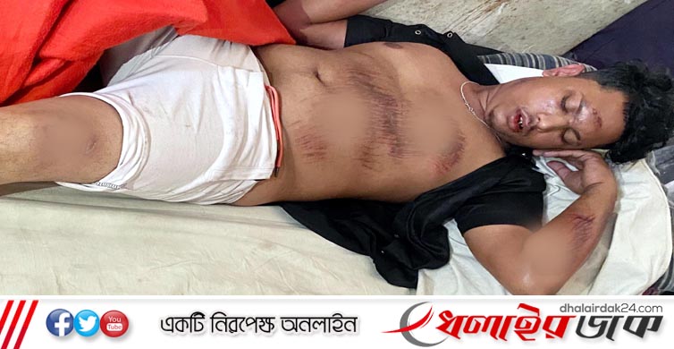 কমলগঞ্জে সিএনজি চালককে ফিল্মি স্টাইলে বেধরক মারধর, থানায় অভিযোগ